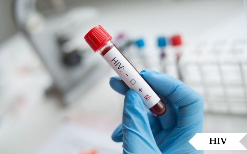 HIV